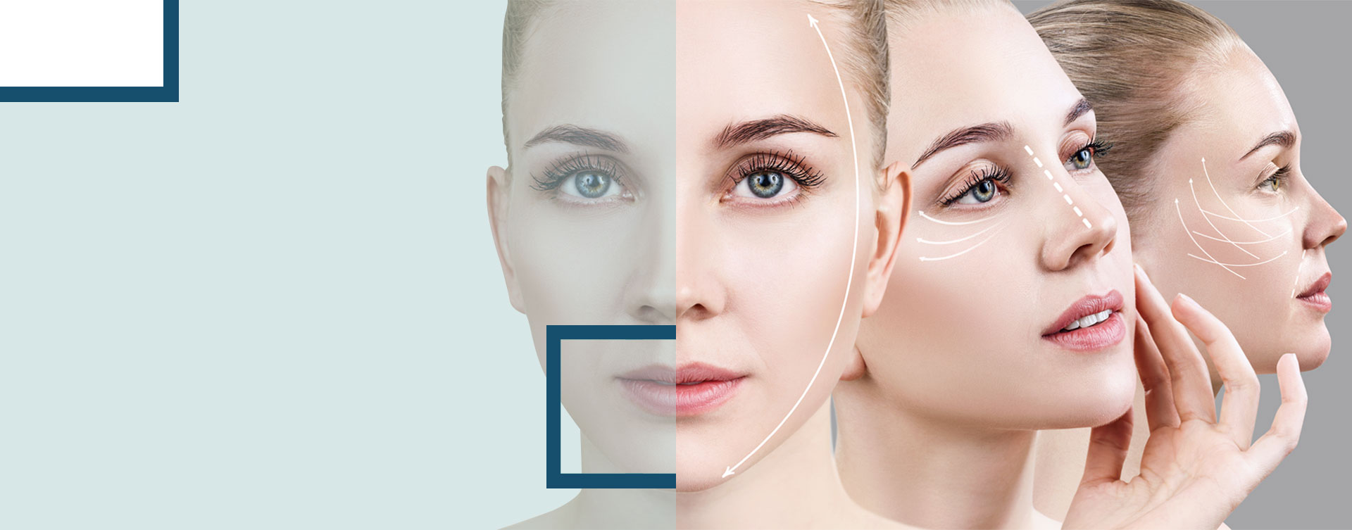 lorem ipsum dolor sit