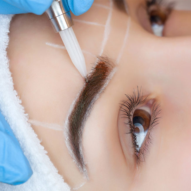 Eyebrow Transplant