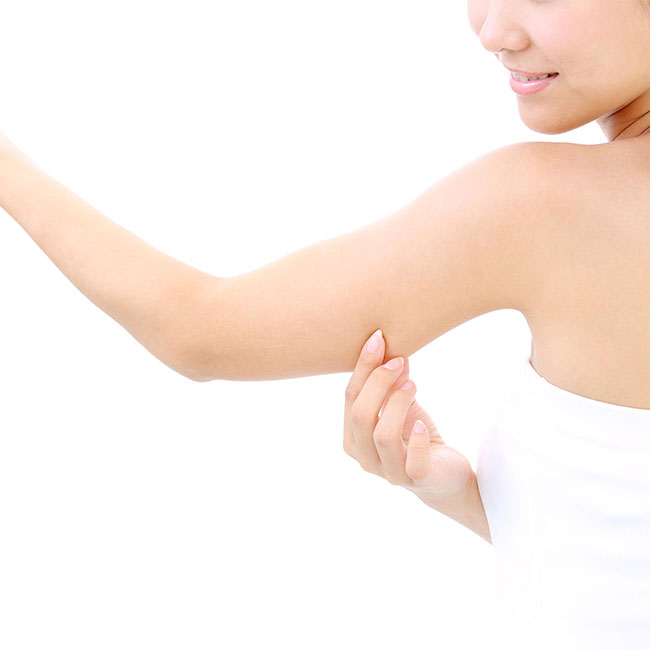Arm Lift