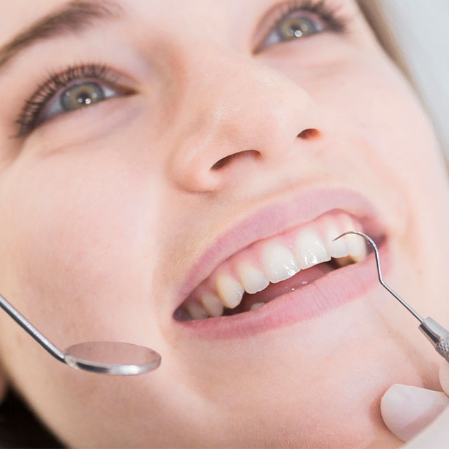 Smile Design