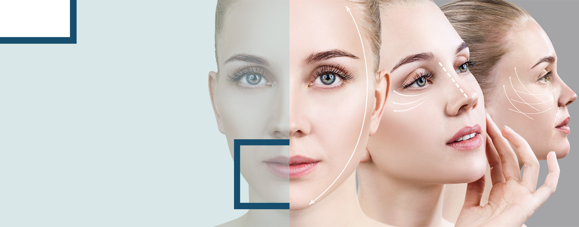 lorem ipsum dolor sit