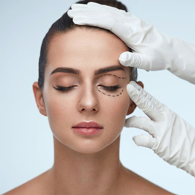 Blepharoplasty