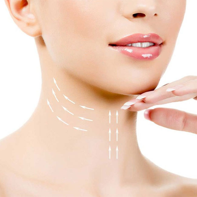 Neck Lift