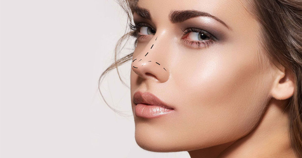Deciding to Undergo Rhinoplasty